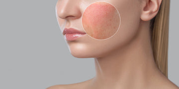 Why Your Skin Feels Worse After Using “Good” Skincare
